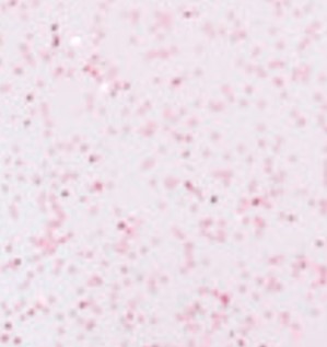 Pink Glitter